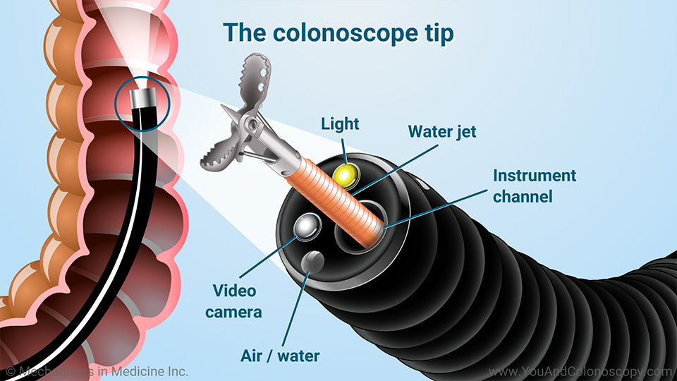 What Happens During And After A Colonoscopy