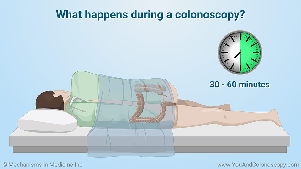 What happens during and after a colonoscopy?