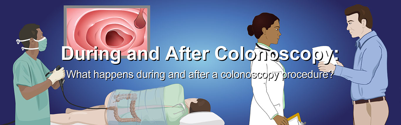 Colonoscopy Procedure: What Happens during and after a Colonoscopy  Procedure? WATCH NOW