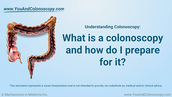 Understanding and Preparing for Colonoscopy