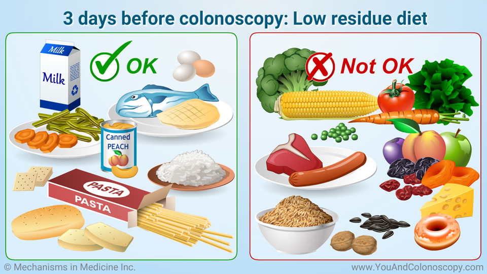 What Is A Colonoscopy And How Do I Prepare For It 